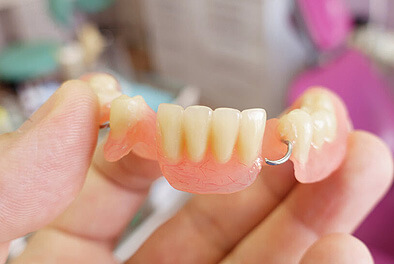 img-Partial-Denture