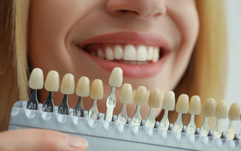 Cosmetic Dentistry - KEA Smile Studio Of Tampa, FL